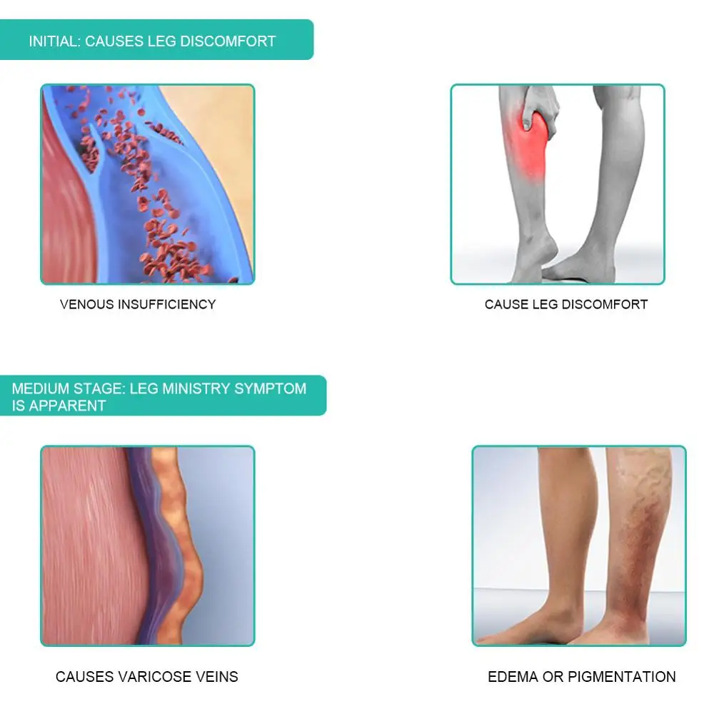 1คู่ถุงเท้าการบีบอัดทางการแพทย - Compression Sock Medical บทวิจารณ์และราคา