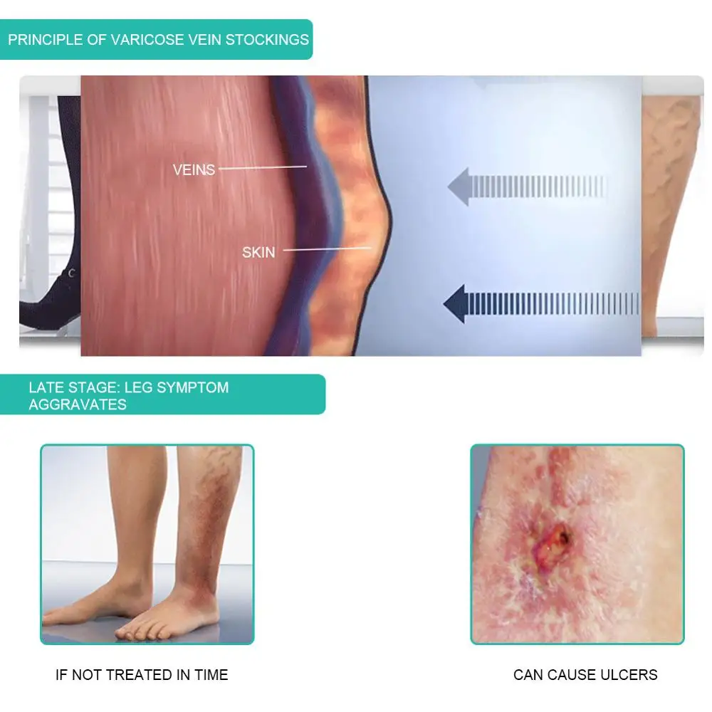1คู่ถุงเท้าการบีบอัดทางการแพทย - Compression Sock Medical บทวิจารณ์และราคา